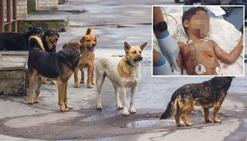 Sokak köpeklerinin saldırısına uğrayan 5 yaşındaki Abbas Haşmet