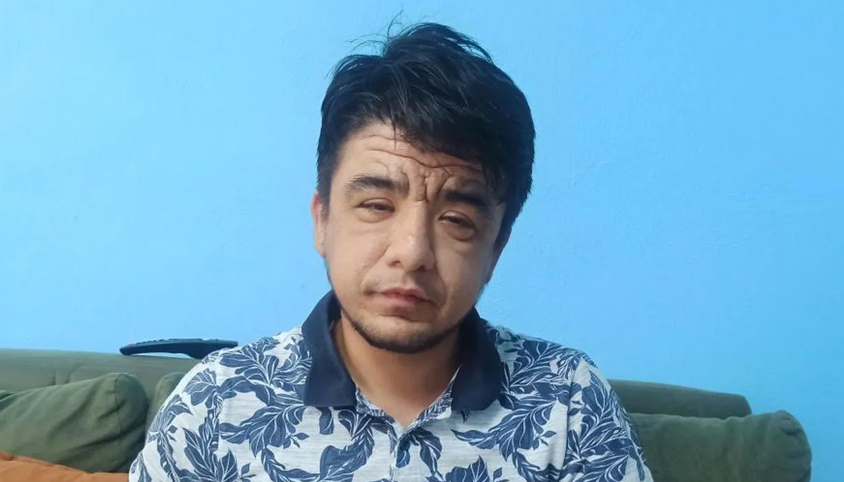 Dünyada nadir görülen hastalığa yakalandı! Yaşını duyan inanamıyor