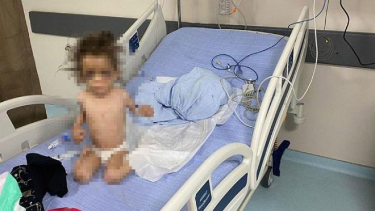 Öz annesi bu hale getirdi! İşkence yapılıp aç bırakılan 5 yaşındaki çocuk yoğun bakımda