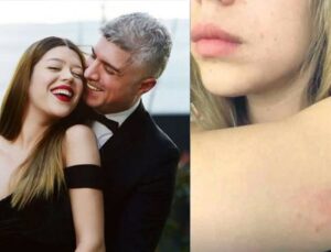 Özcan Deniz ‘eski eşine şiddet uyguladı’ iddiası! Fotoğraflar ortaya çıktı